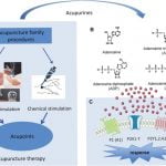 Vía de Señalización Purinergica como Mecanismo de Acción de la Acupuntura en el Dolor
