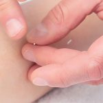 Revisión Sistemática y Meta-análisis en Red del efecto de la Acupuntura en el Estreñimiento post-Ictus