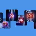 Comparación de la eficacia de la terapia relacionada con la acupuntura en el tratamiento de la artritis reumatoide: un metanálisis en red de ensayos controlados aleatorios. (Wan R.et al.,2022)