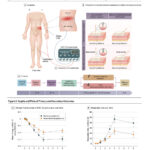 Efecto de la electroacupuntura en la neuralgia posherpética: un ensayo clínico aleatorizado (Chen L et al. JAMA Neurol. 2026)