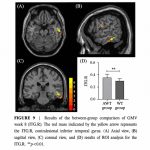 Neurorrehabilitación combinando acupuntura y rehabilitación convencional en el ictus isquémico agudo: evidencia mediante resonancia magnética multimodal (Li F et al. Neural Plast. 2026)