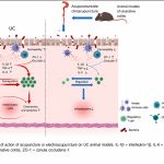 Una revisión sistemática y metaanálisis de la acupuntura para la protección intestinal y sus mecanismos subyacentes en modelos animales de colitis ulcerosa. (Zhang J et al. Medicine (Baltimore). 2026)